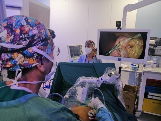 Annunziata: la chirurgia bariatrica si fa con la robotica